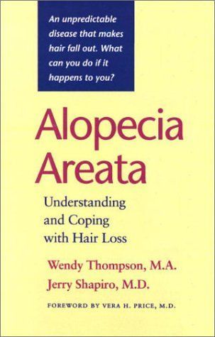 Alopecia Areata