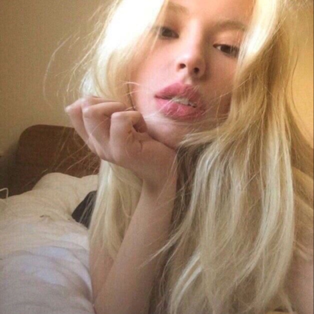 Photo of rhi